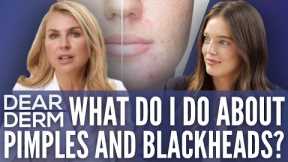 What do I do about pimples and blackheads? Emily DiDonato & Dr. Julie Russak | Model Skincare