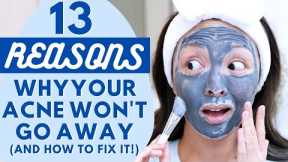 13 Reasons Why Your Acne WON'T Go Away (And How To Fix It!)