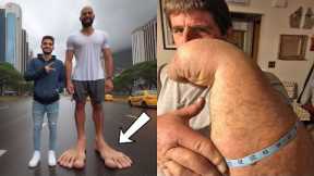 People With The Longest Body Parts in the World